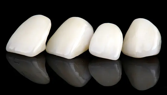 オールセラミック