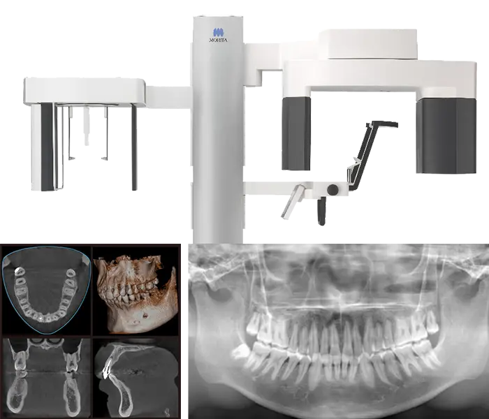 歯科用デジタルレントゲン・CT