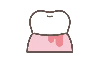 歯周病治療