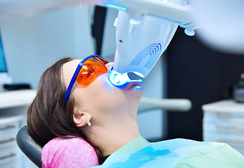 オフィスホワイトニング