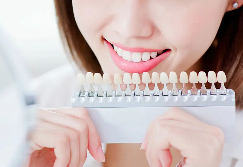 ホワイトニング