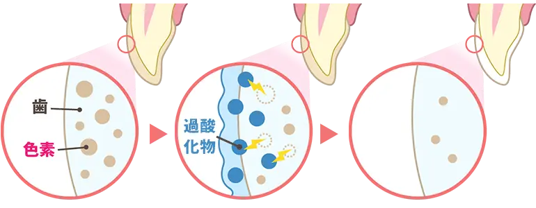 ホワイトニングの仕組み